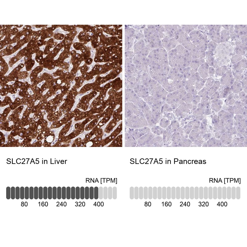 Analysis in human liver and pancreas tissues using NBP3-44432 antibody. Corresponding FATP5/SLC27A5 RNA-seq data are presented for the same tissues.