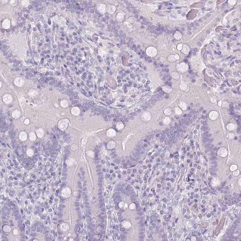 Staining of human duodenum shows no positivity in glandular cells as expected.