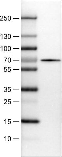 Lane 1: Marker [kDa]Lane 2: Human liver tissue lysate