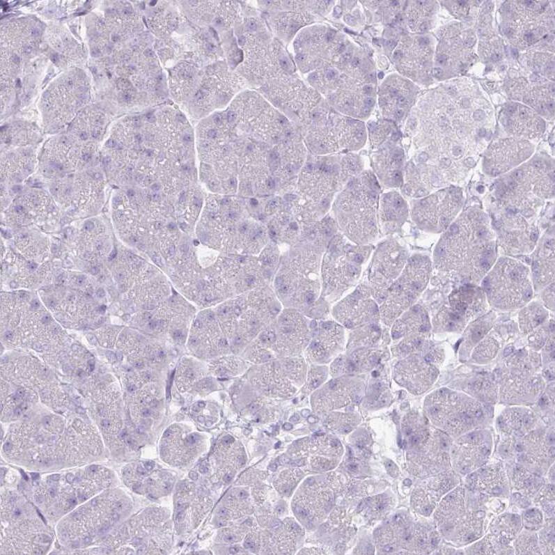 Staining of human pancreas shows no positivity in exocrine glandular cells as expected.