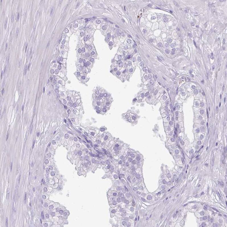 Staining of human prostate shows no positivity in glandular cells as expected.
