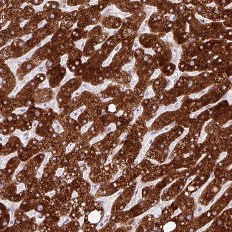 Staining of human liver shows strong cytoplasmic positivity in hepatocytes.