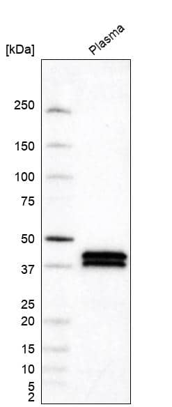 Analysis in human plasma.