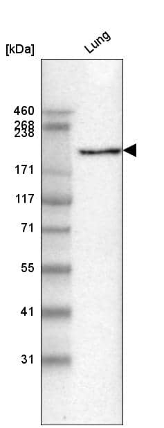 Analysis in human lung tissue.