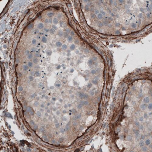 Staining of human testis shows immunoreactivity in basement membrane of seminiferous tubules.