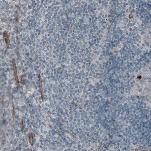 Staining of human tonsil shows absence of immunoreactivity in lymphoid cells (negative control).