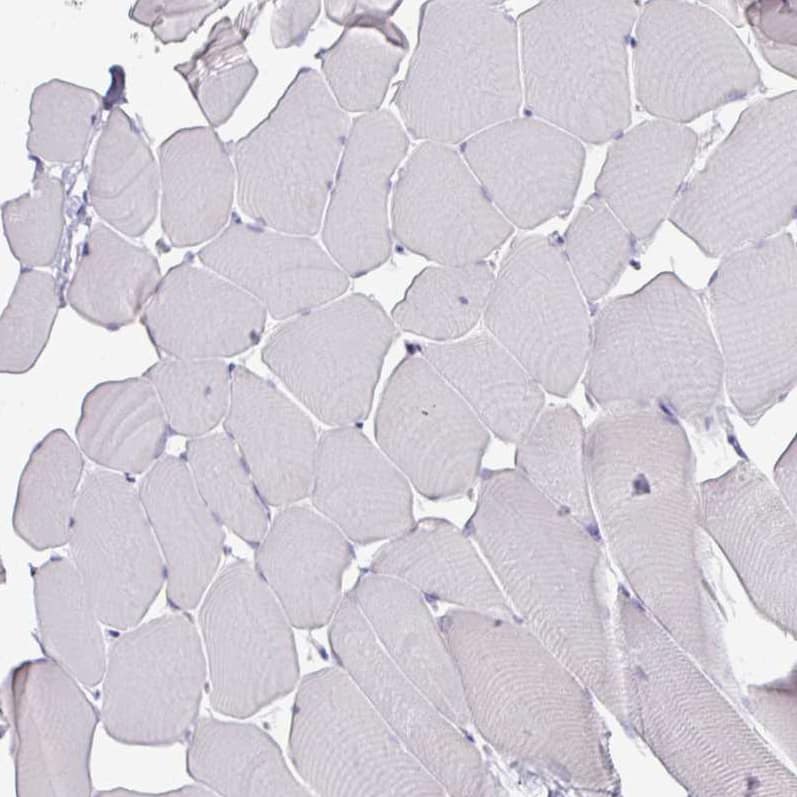 Staining of human skeletal muscle shows no nuclear positivity in striated muscle fibers as expected.