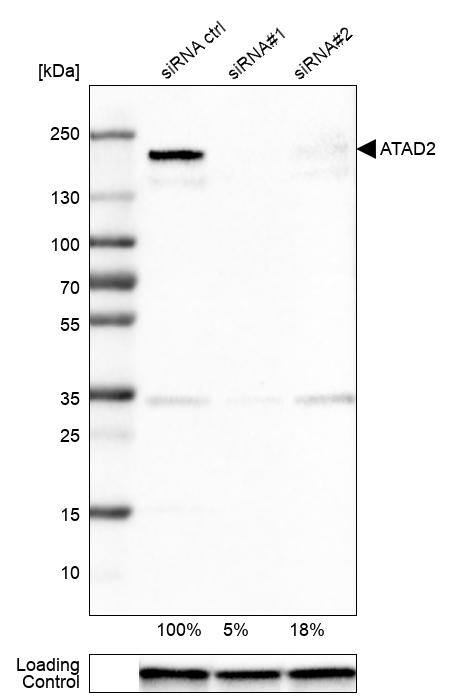 Analysis in U-251MG cells transfected with control siRNA, target specific siRNA probe #1 and #2, using Anti-ATAD2 antibody. Remaining relative intensity is presented. Loading control: Anti-GAPDH.