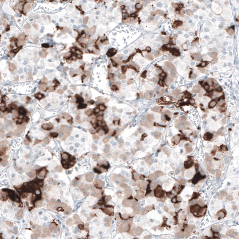 Staining of human pituitary gland shows strong cytoplasmic positivity in a subset of neuroendocrine cells.