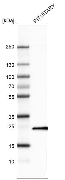 Analysis in human pituitary gland tissue.