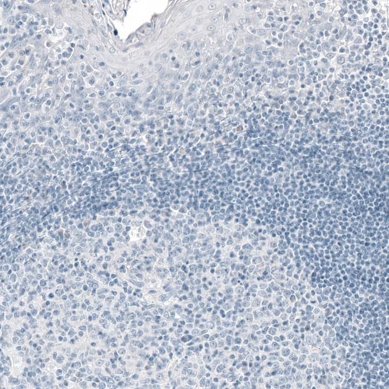 Staining of human tonsil shows no positivity in lymphoid cells as expected.