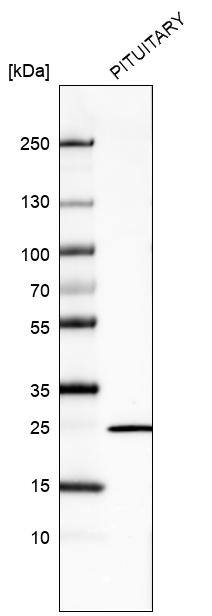 Analysis in human pituitary gland tissue.