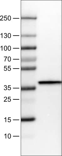 Lane 1: Marker [kDa]Lane 2: Human liver tissue lysate