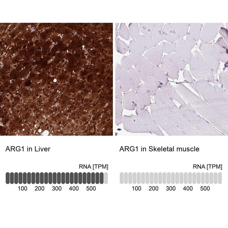 Analysis in human liver and skeletal muscle tissues using NBP3-44441 antibody. Corresponding Arginase 1/ARG1/liver Arginase RNA-seq data are presented for the same tissues.