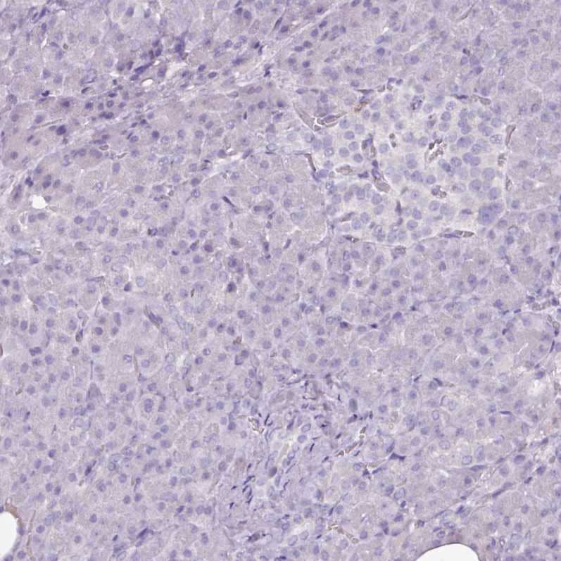 Staining of human pancreas shows no positivity in exocrine glandular cells as expected.