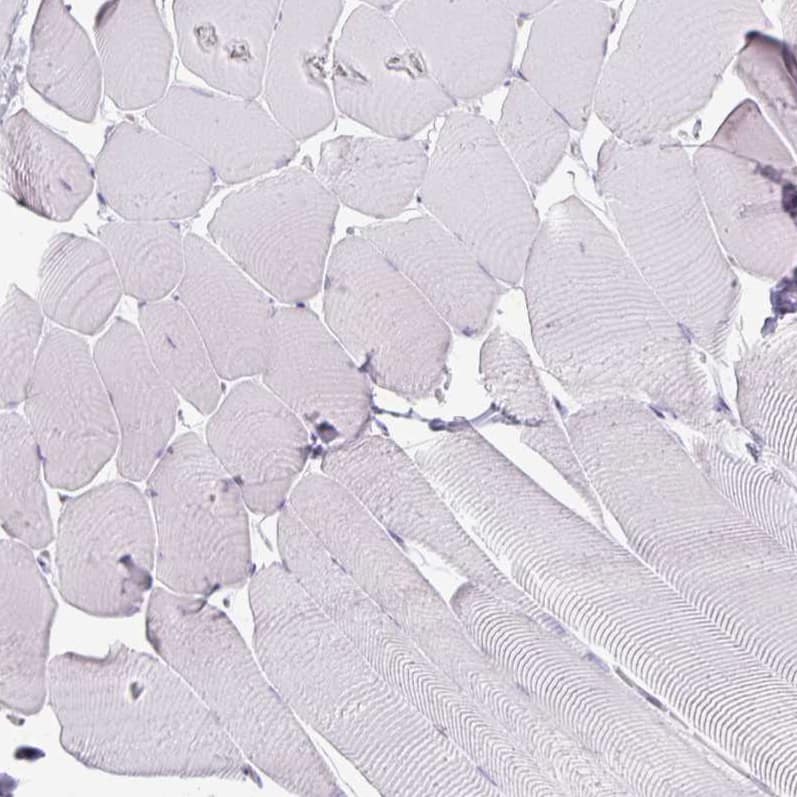 Staining of human skeletal muscle shows no positivity in myocytes as expected.