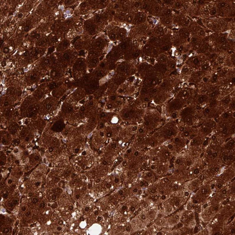 Staining of human liver shows strong cytoplasmic and nuclear positivity in hepatocytes.