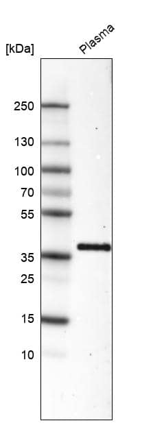 Analysis in human plasma.