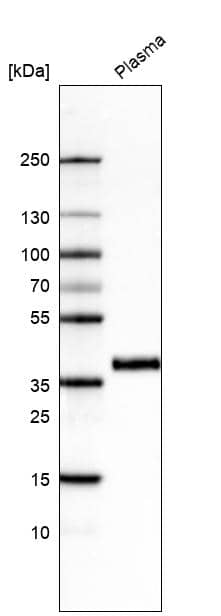 Analysis in human plasma.