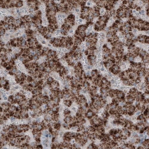 Staining of human liver shows strong granular cytoplasmic positivity in hepatocytes.