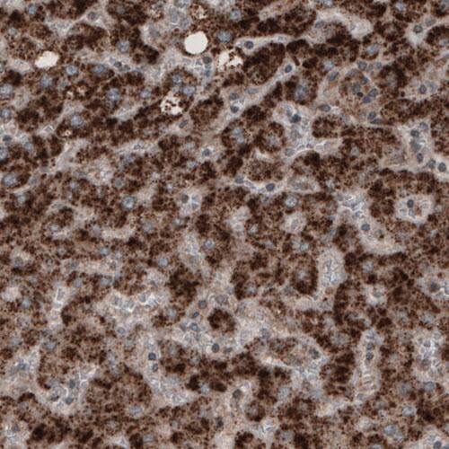 Staining of human liver shows strong granular cytoplasmic positivity in hepatocytes.