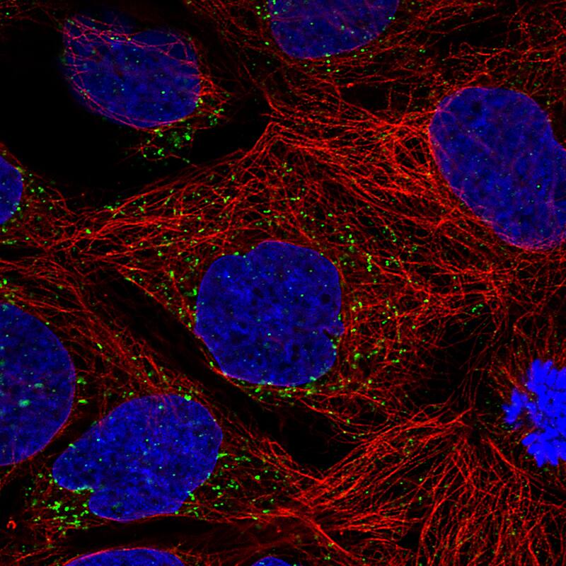 Staining of CACO-2 cells using the Anti-ACAA1 monoclonal antibody) .