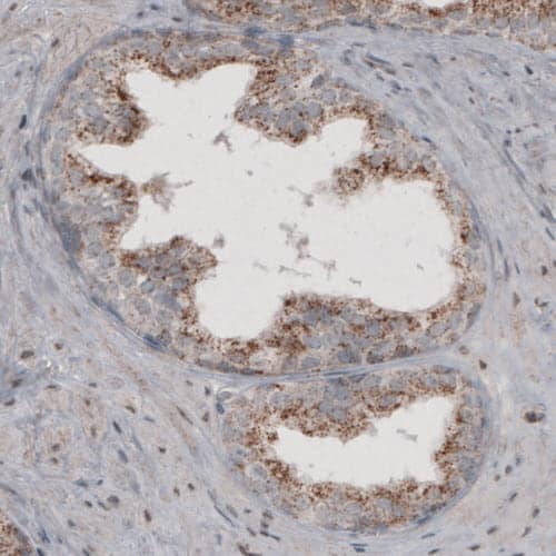 Staining of human prostate shows granular cytoplasmic immunoreactivity in glandular cells.