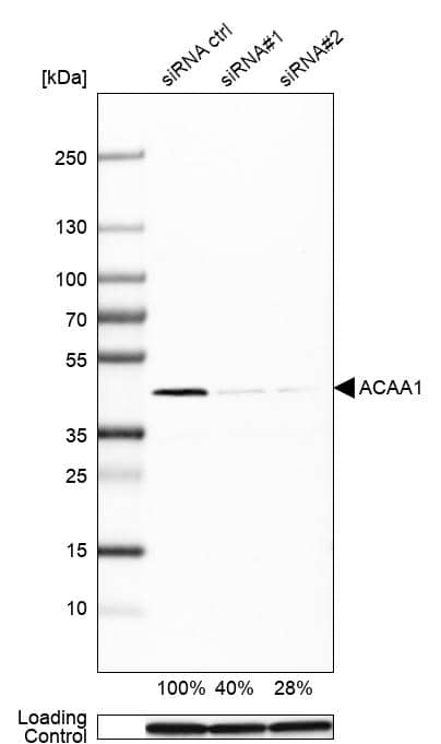 Analysis in U-251MG cells transfected with control siRNA, target specific siRNA probe #1 and #2, using Anti-ACAA1 antibody. Remaining relative intensity is presented. Loading control: Anti-PPIB.