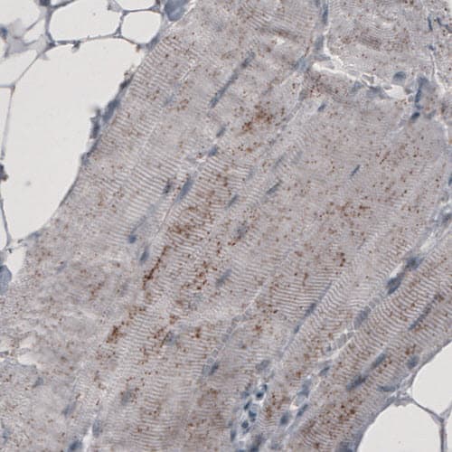 Staining of human skeletal muscle shows granular cytoplasmic positivity.