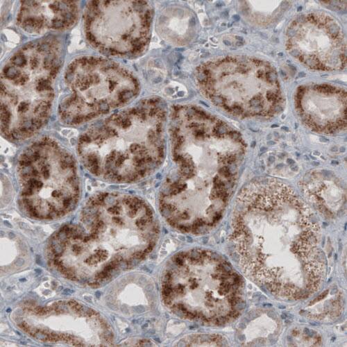 Staining of human kidney shows granular cytoplasmic immunoreactivity in renal tubules.