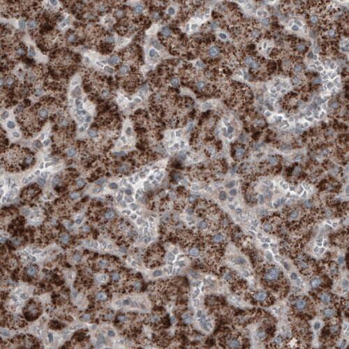 Staining of human liver shows strong granular cytoplasmic positivity in hepatocytes.
