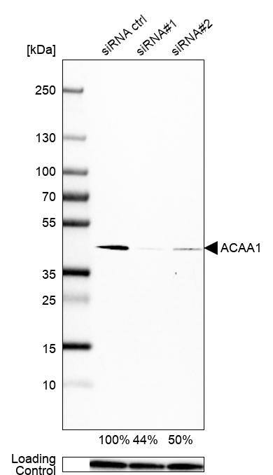 Analysis in U-251MG cells transfected with control siRNA, target specific siRNA probe #1 and #2, using Anti-ACAA1 antibody. Remaining relative intensity is presented. Loading control: Anti-PPIB.