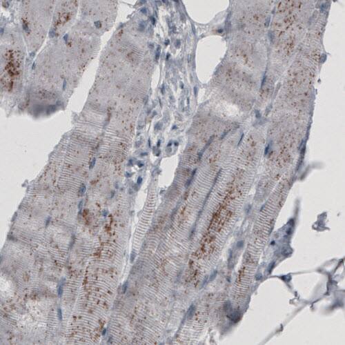 Staining of human skeletal muscle shows granular cytoplasmic positivity.