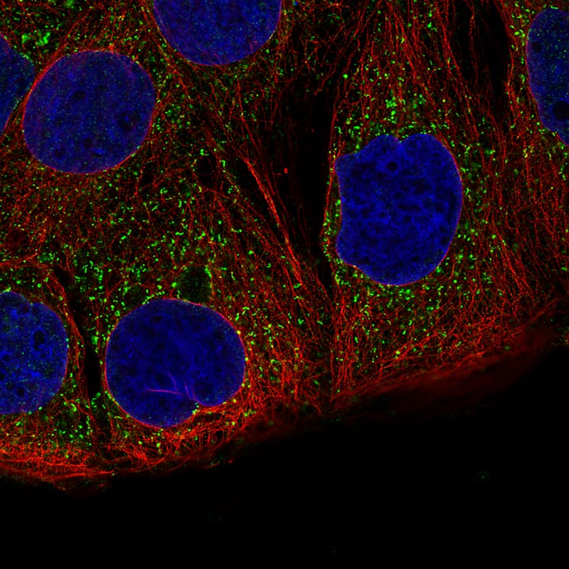 Staining of CACO-2 cells using the Anti-ACAA1 monoclonal antibody) .