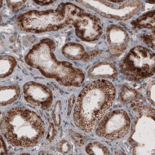 Staining of human kidney shows granular cytoplasmic immunoreactivity in renal tubules.