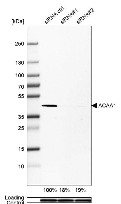 Analysis in U-251MG cells transfected with control siRNA, target specific siRNA probe #1 and #2, using Anti-ACAA1 antibody. Remaining relative intensity is presented. Loading control: Anti-PPIB.