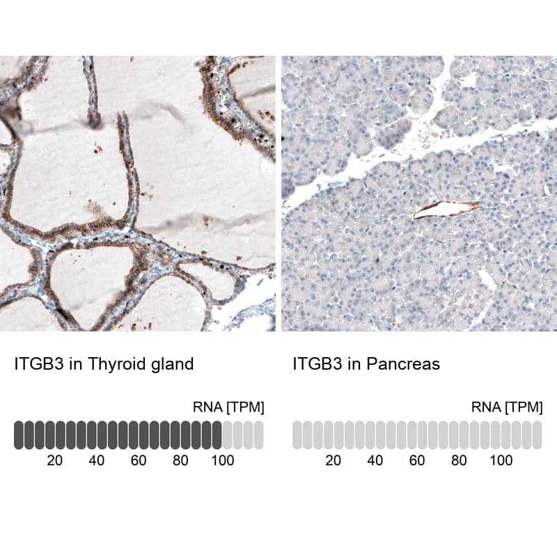 Analysis in human thyroid gland and pancreas tissues using NBP3-44448 antibody. Corresponding Integrin beta 3/CD61 RNA-seq data are presented for the same tissues.