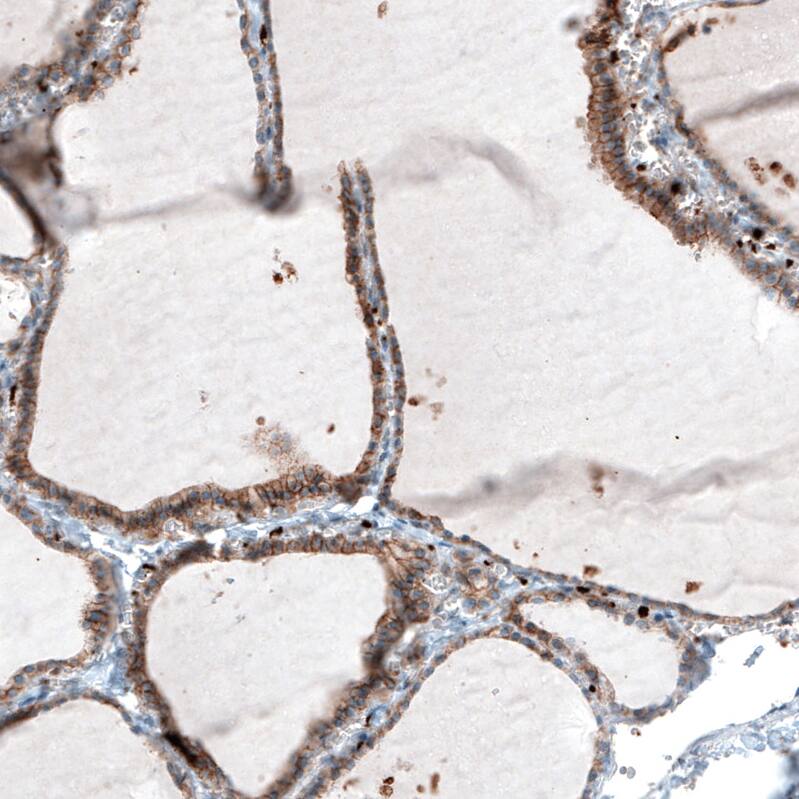 Staining of human thyroid gland shows moderate membranous positivity in glandular cells.