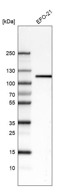 Analysis in human cell line EFO-21.