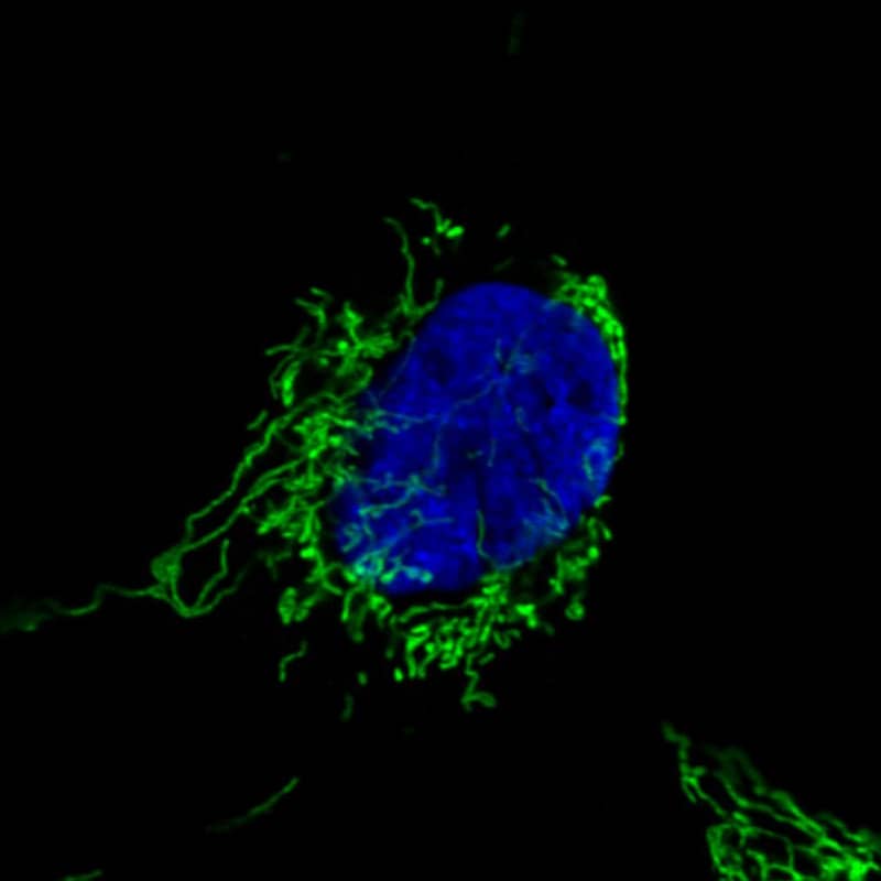 Staining in U251 cell line with Anti-CS Citrate Synthase monoclonal antibody) .