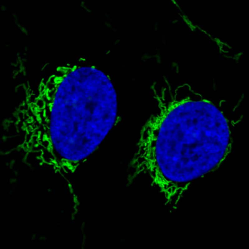 Staining in U2OS cell line with Anti-CS Citrate Synthase monoclonal antibody) .