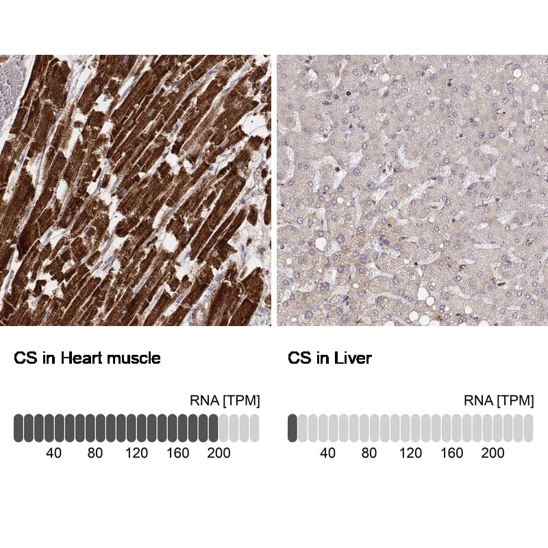 Analysis in human heart muscle and liver tissues using NBP3-44449 antibody. Corresponding CS Citrate Synthase RNA-seq data are presented for the same tissues.