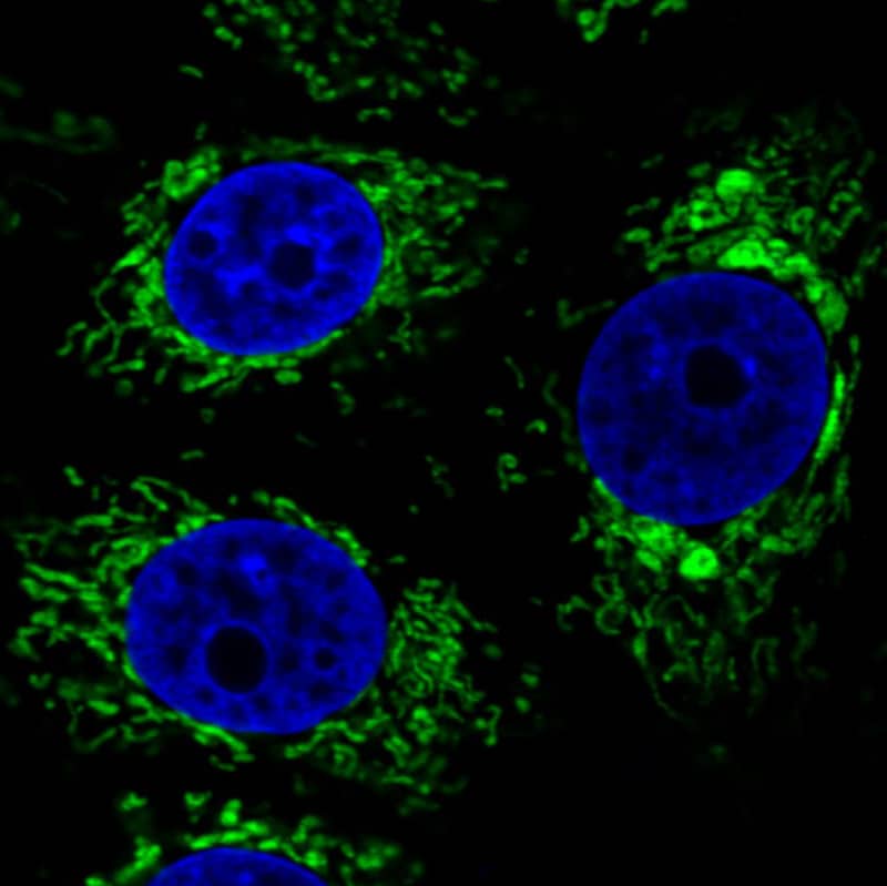 Staining in MCF7 cell line with Anti-CS Citrate Synthase monoclonal antibody) .