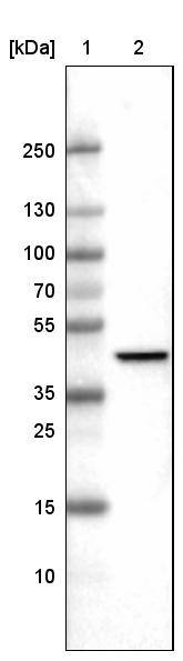 Lane 1: Marker [kDa]Lane 2:Human cell line U-251 MG