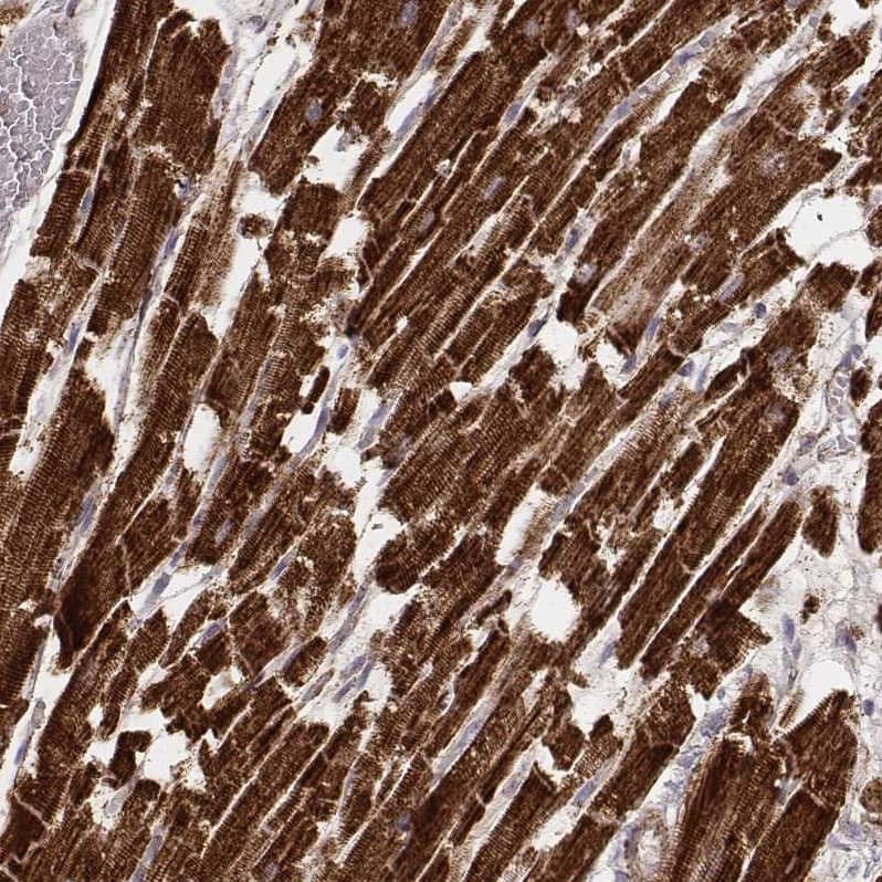 Staining of human heart muscle shows strong cytoplasmic positivity in cardiomyocytes.