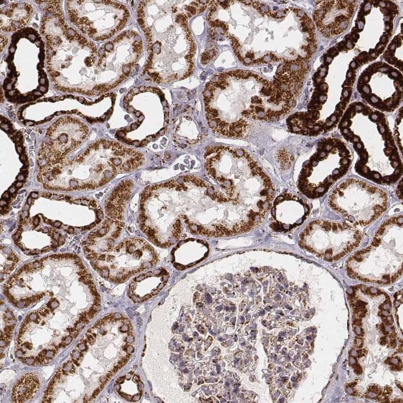 Staining of human kidney shows moderate to strong cytoplasmic positivity in cells in tubules.