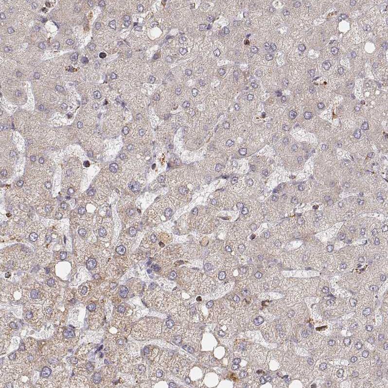 Staining of human liver shows no positivity in hepatocytes as expected.