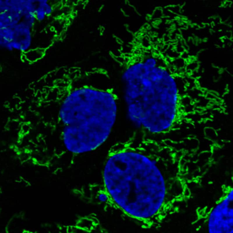 Staining in A431 cell line with Anti-CS Citrate Synthase monoclonal antibody) .