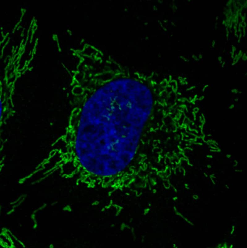 Staining in HeLa cell line with Anti-CS Citrate Synthase monoclonal antibody) .