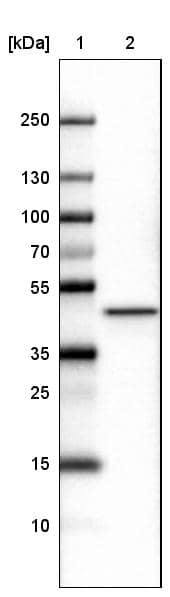 Lane 1: Marker [kDa]Lane 2: Human cell line U-251 MG